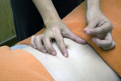 acupuncture-01.jpg